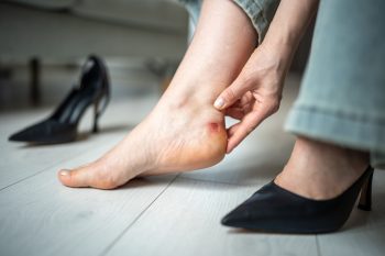 Obtarte stopy od butów – co stosować na otarcia i pęcherze?