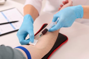 MCHC – co to jest? Co oznacza wynik poniżej lub powyżej normy?
