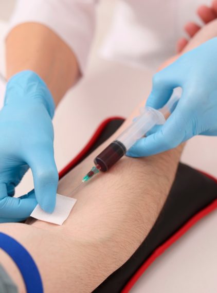 MCHC – co to jest? Co oznacza wynik poniżej lub powyżej normy?