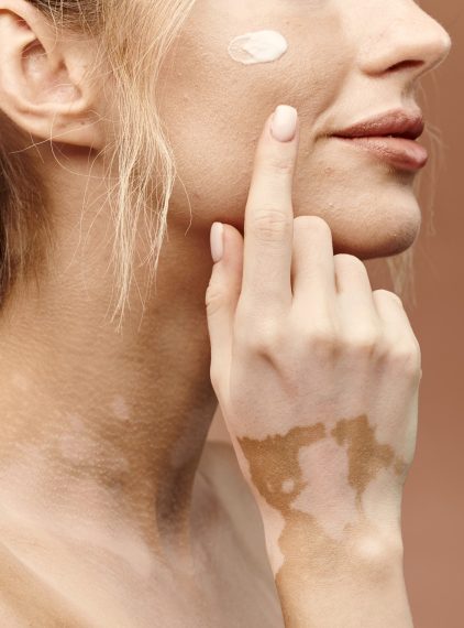 Melanina. Co to jest, gdzie powstaje i jakie pełni funkcje?