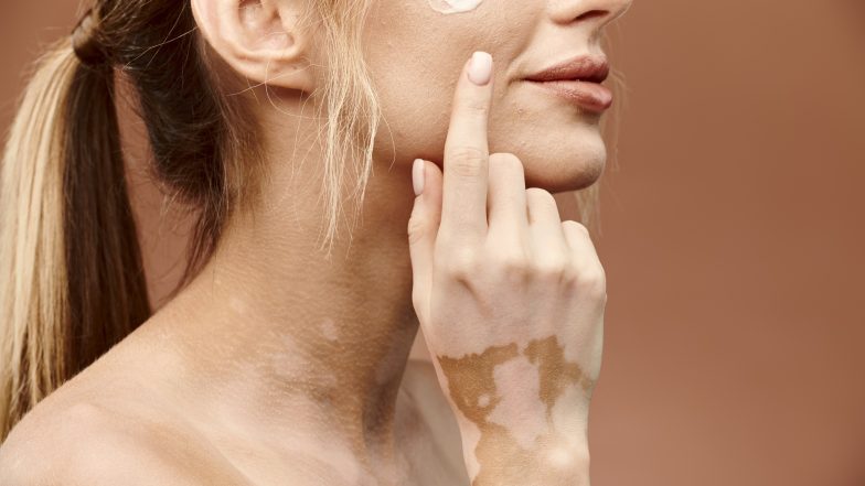 Melanina. Co to jest, gdzie powstaje i jakie pełni funkcje?