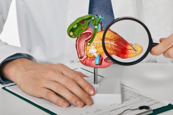 Nowy lek na raka trzustki. Rasonque (daraxonrasib) zatwierdzony przez FDA
