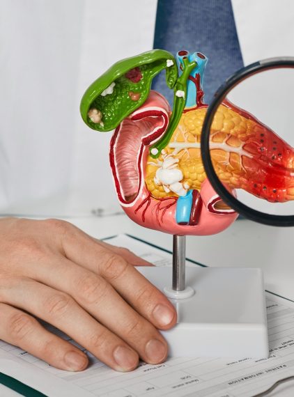 Nowy lek na raka trzustki. Rasonque (daraxonrasib) zatwierdzony przez FDA