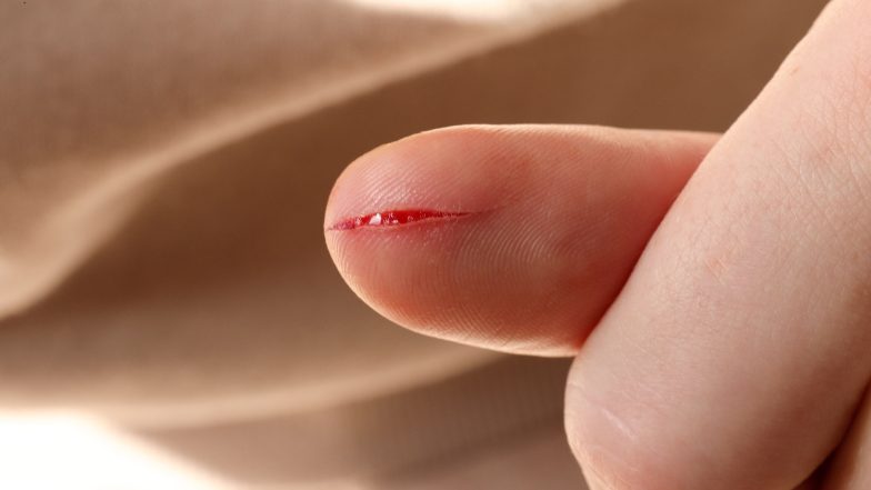 Rana cięta. Jak powstaje, jak się goi i kiedy można ją zszyć?