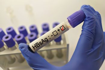 Antygen HBs (HBsAg). Normy, badanie i interpretacja wyników