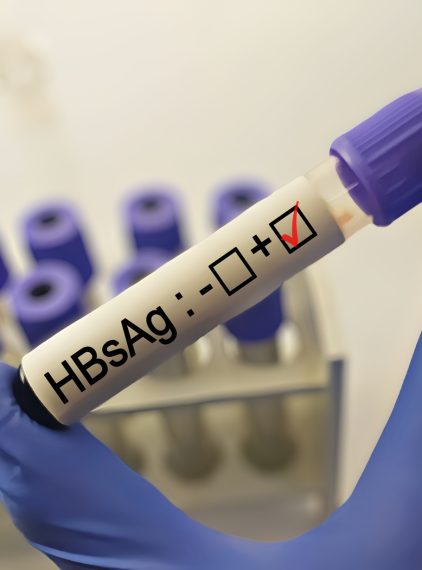 Antygen HBs (HBsAg). Normy, badanie i interpretacja wyników