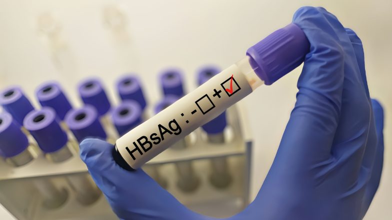 Antygen HBs (HBsAg). Normy, badanie i interpretacja wyników