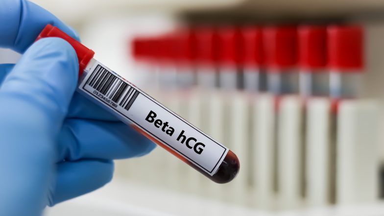 Badanie beta hCG. Normy, wynik i interpretacja