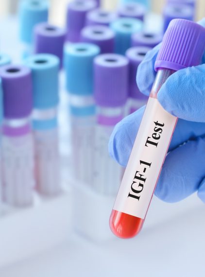 IGF-1 (insulinopodobny czynnik wzrostu). Normy, przygotowanie i interpretacja wyników