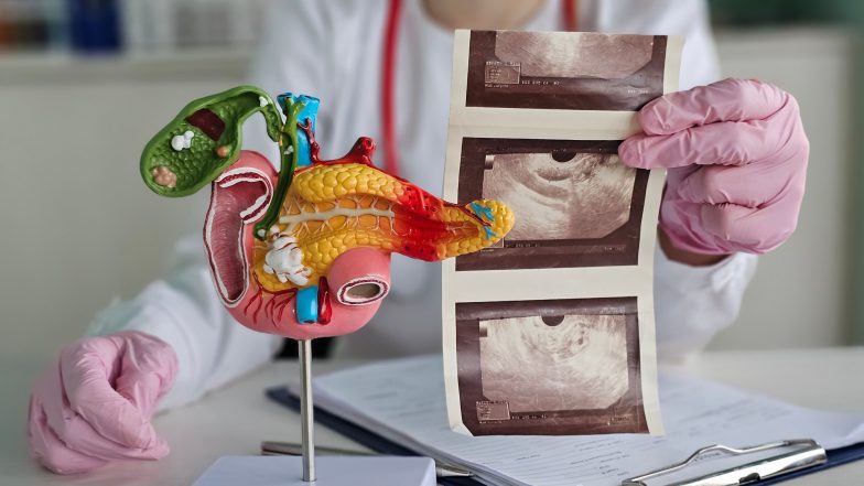 AI wykrywa oznaki raka trzustki nawet kilka lat przed diagnozą. Nowe wyniki badań