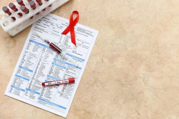 Test na HIV. Badanie, wynik i interpretacja