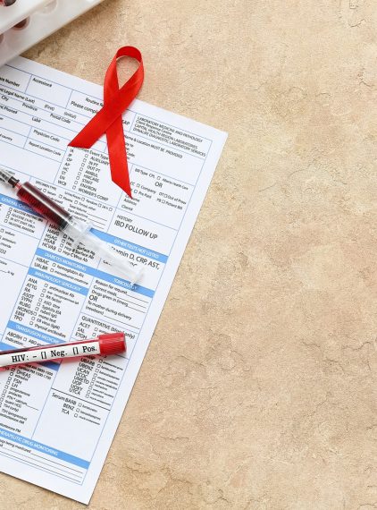 Test na HIV. Badanie, wynik i interpretacja
