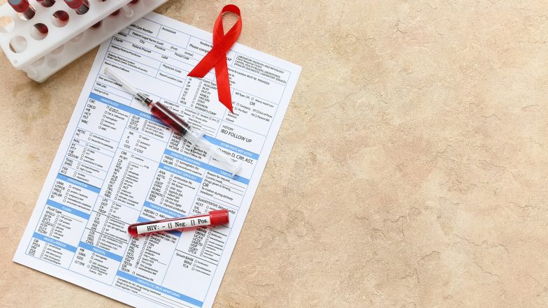 Test na HIV. Badanie, wynik i interpretacja