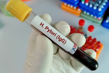 Helicobacter pylori IgG. Normy, badanie i interpretacja wyników
