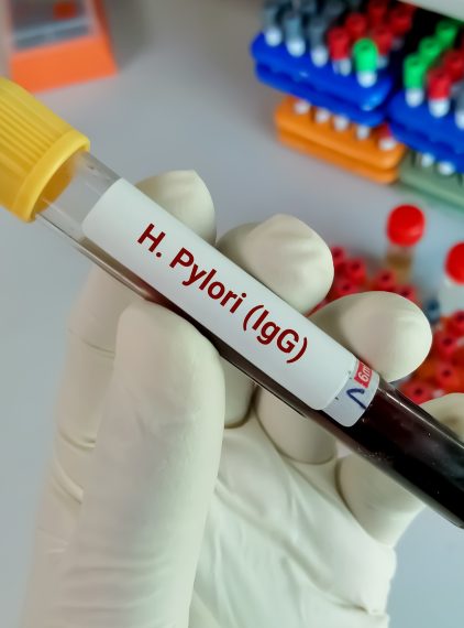 Helicobacter pylori IgG. Normy, badanie i interpretacja wyników
