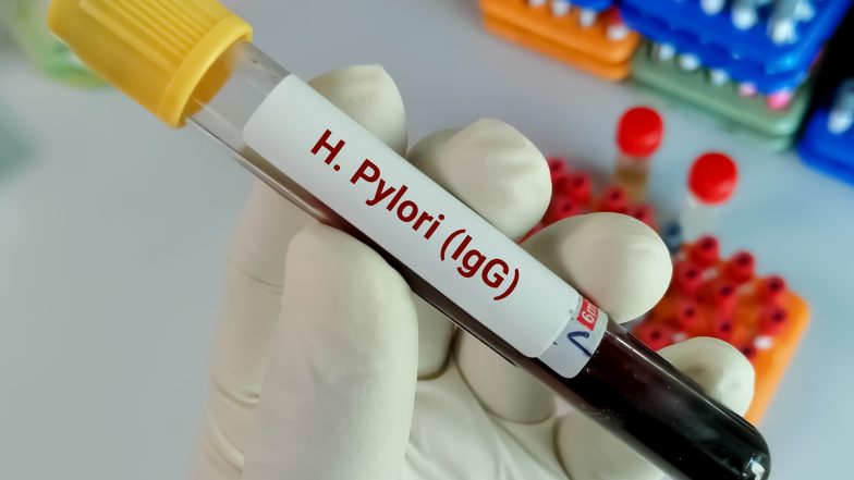 Helicobacter pylori IgG. Normy, badanie i interpretacja wyników